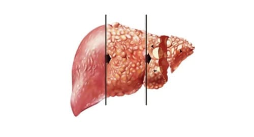 Liverin precio farmacia similares